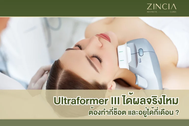 Ultraformer III ได้ผลจริงไหม ต้องทำกี่ช็อต และอยู่ได้กี่เดือน